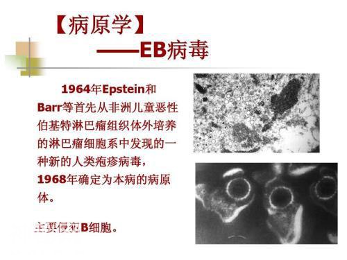 恐艾的人查出了一个绝大多数人感染过的病毒：一文了解EB病毒感染-12.jpg