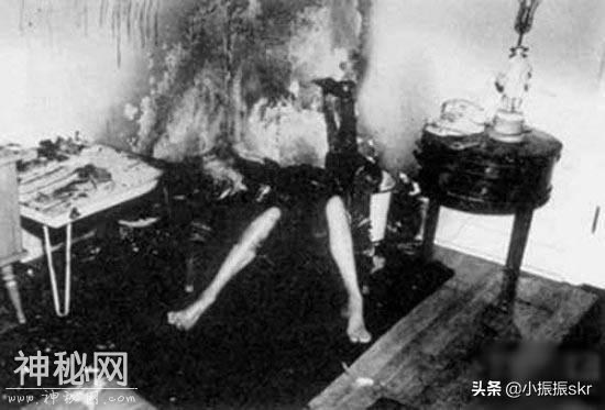 《野史》让人一听就毛骨悚然的世界未解之谜：人类离奇自燃-2.jpg