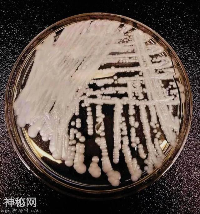 超级细菌大爆发，你和你的家人会感染吗？-2.jpg