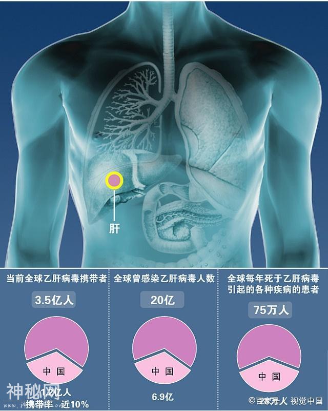 我国为什么是乙肝大国？这是一笔历史遗留账！-2.jpg