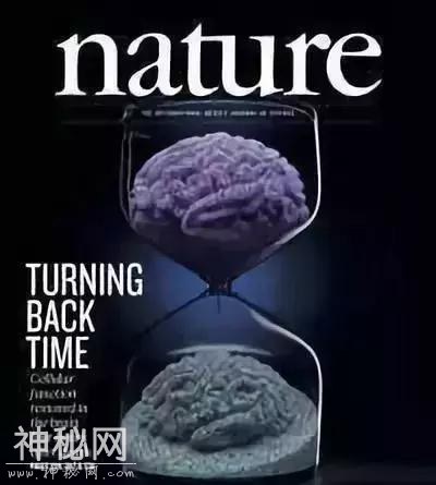 人类可能要战胜死亡了！重磅科技突破：短暂复活死掉的大脑-3.jpg