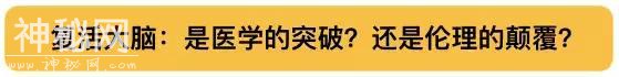 人类可能要战胜死亡了！重磅科技突破：短暂复活死掉的大脑-4.jpg