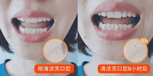 可以吸的口香糖，口臭终结者！吸一口杀灭99%口腔细菌-12.jpg