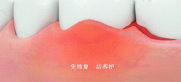 可以吸的口香糖，口臭终结者！吸一口杀灭99%口腔细菌-13.jpg