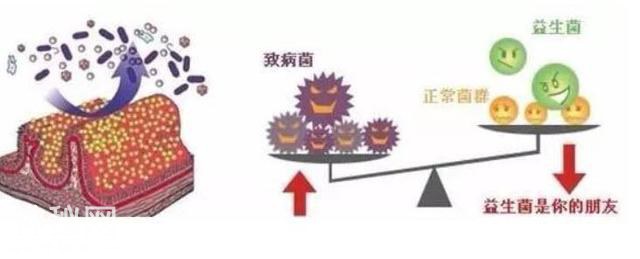 肠道菌群很重要，高质量的饮食可能会增加有益细菌的数量-3.jpg