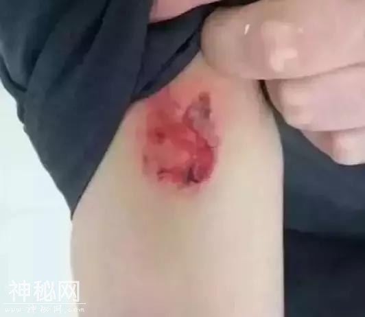 艾滋病病毒携带者暴力抗法咬伤法官，咬人者被批捕-2.jpg