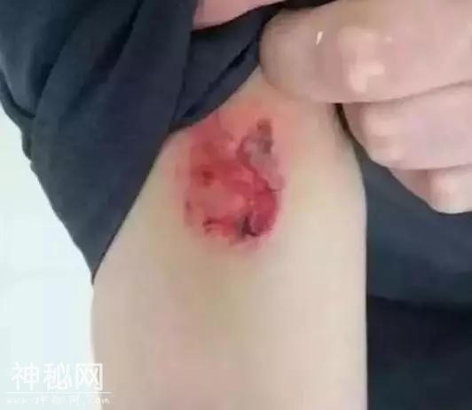 艾滋病病毒携带者暴力抗法，故意咬伤法官……-2.jpg