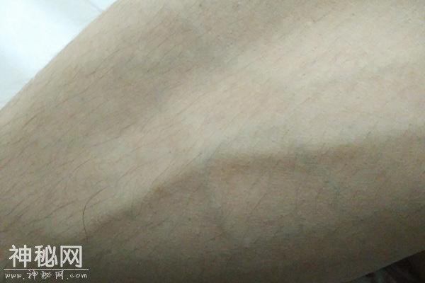 为何有人手上青筋凸起明显？青筋多就代表身体差吗？告诉你真相-2.jpg