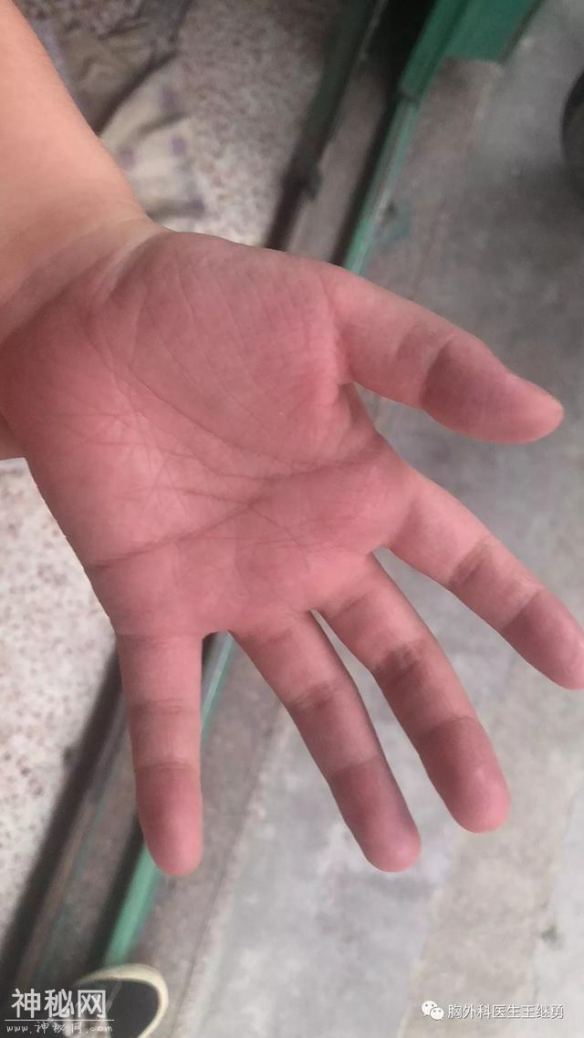 这不是绝症-2.jpg