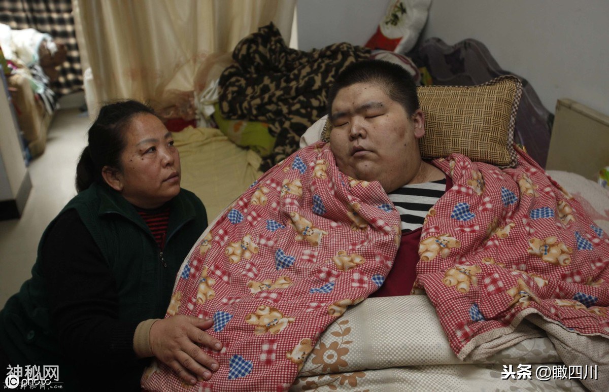 男子患怪病，4年暴涨400斤，央求妈妈安乐死-3.jpg
