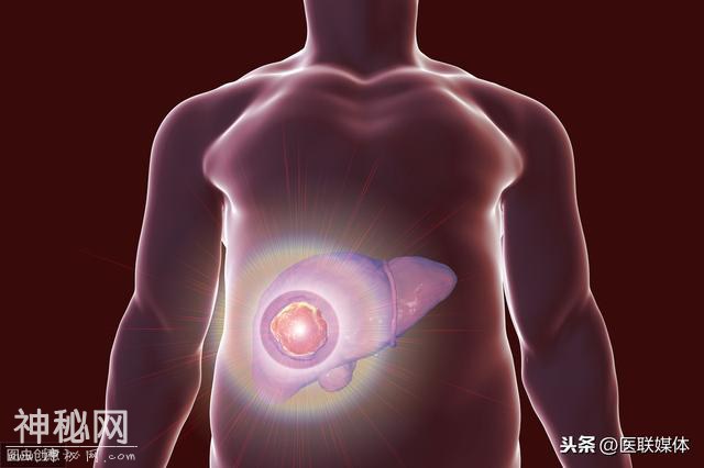肝脏有问题时，身体可能表现这3个“模样”，辨认清楚了-1.jpg