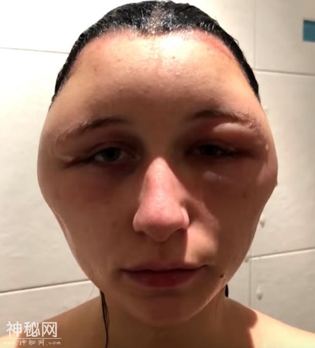 染发染到毁容加失明，变成外星人的她表示再也不会染发了-10.jpg
