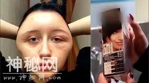 染发染到毁容加失明，变成外星人的她表示再也不会染发了-9.jpg