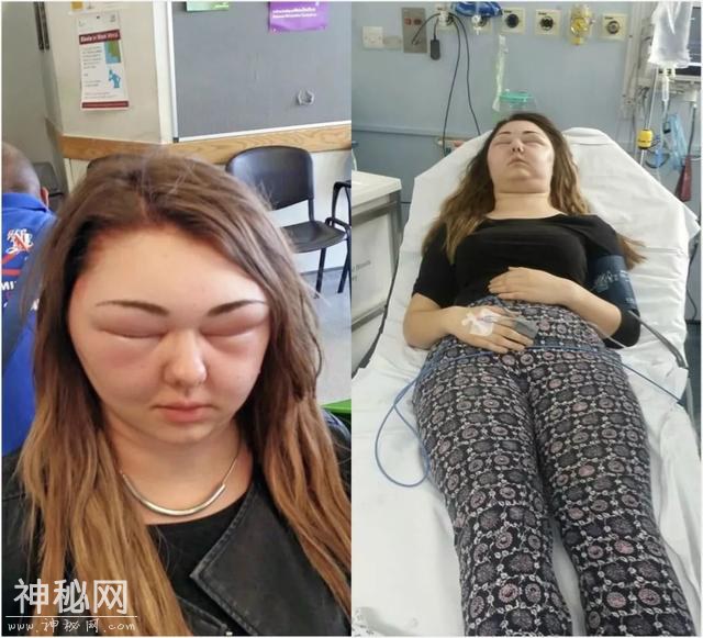 染发染到毁容加失明，变成外星人的她表示再也不会染发了-7.jpg