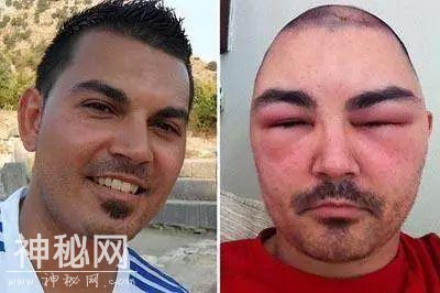 染发染到毁容加失明，变成外星人的她表示再也不会染发了-18.jpg