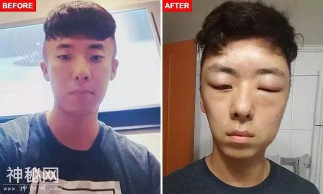 染发染到毁容加失明，变成外星人的她表示再也不会染发了-20.jpg
