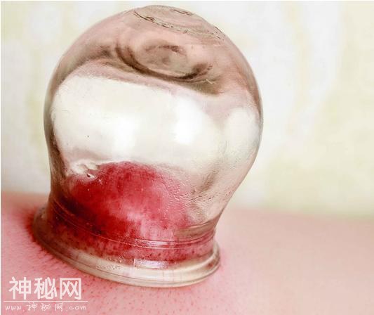 湿气重的人，身体会有3种现象！中医推荐：4个方法将湿毒排出体内-5.jpg