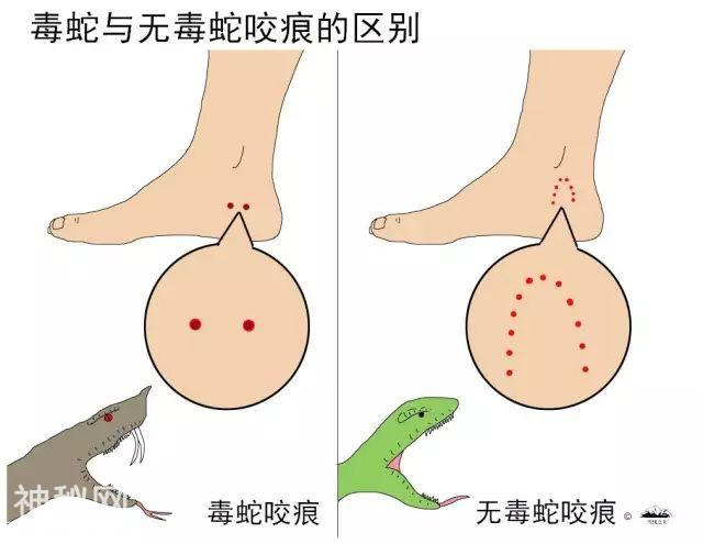 提醒！已有100多人被蛇咬伤，深圳这些地方已发现毒蛇出没-6.jpg