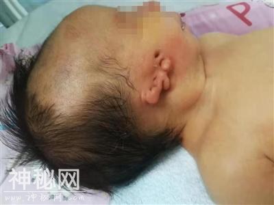 新生儿多处畸形 家长：多次产检都没发现 谁之责？-1.jpg