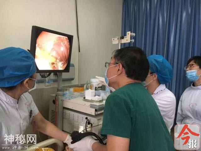 男童得“怪病”反复发烧腹痛，医生进他肚子取出了这东西-1.jpg