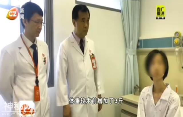 吃进去就吐”女子患罕见怪病暴瘦到30公斤 形似“人体骨架-4.jpg