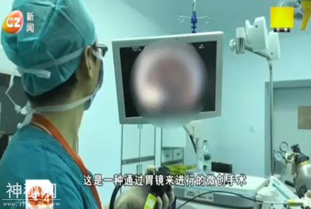 吃进去就吐”女子患罕见怪病暴瘦到30公斤 形似“人体骨架-3.jpg