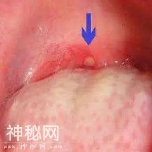 近期在朋友圈疯传的病毒，据说亲吻就能传播？妈妈们可长点心-8.jpg