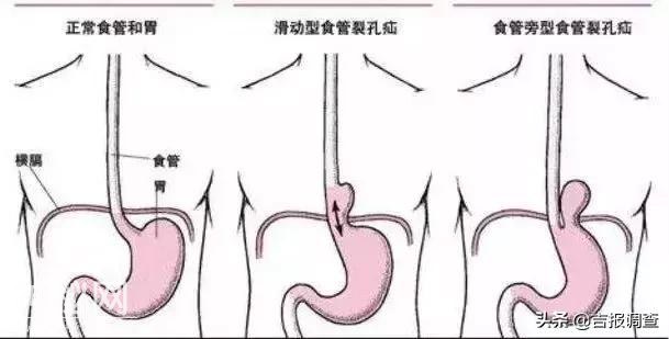 每次饭后都腹痛、腹胀、胸闷，长春市中医院专家为怪病确诊-1.jpg