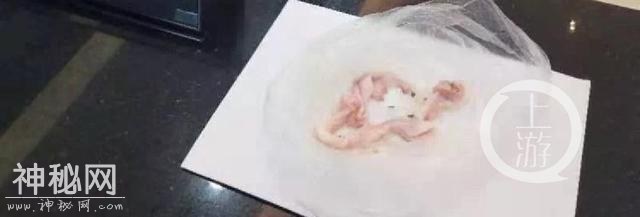 高能预警！行李中竟藏人体胎盘 海关：严禁个人携带未经检疫的人体组织进出境-1.jpg