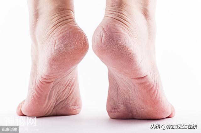 脚后跟痛是怎么一回事？情况频繁，可能是5种疾病在“作妖”-2.jpg