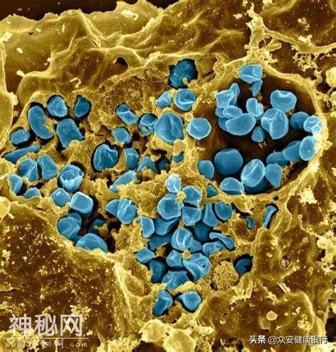 PNAS：研究揭示细菌如何打败免疫系统-1.jpg