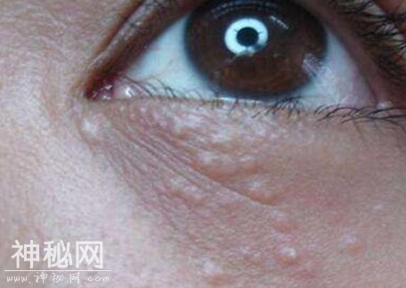 高血脂多是“拖”出来的，提醒：身体若有3种现象，尽早就医-3.jpg