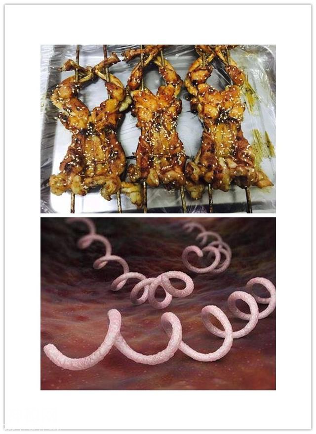 夜市烧烤真的“很脏”，这些细菌寄生虫，一不小心就被你吃下去了-3.jpg
