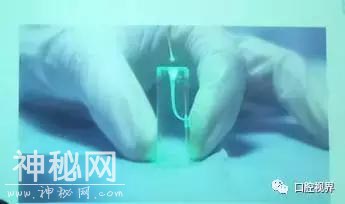 激光在口腔应用中的“灵异事件”《激光在口腔医学的应用学习班》-6.jpg