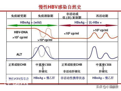 慢乙肝防治的核心是抗病毒-2.jpg