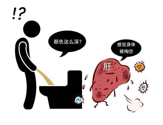 劝告：上厕所时多观察一下，若出现4种现象，或许肝出问题了-2.jpg