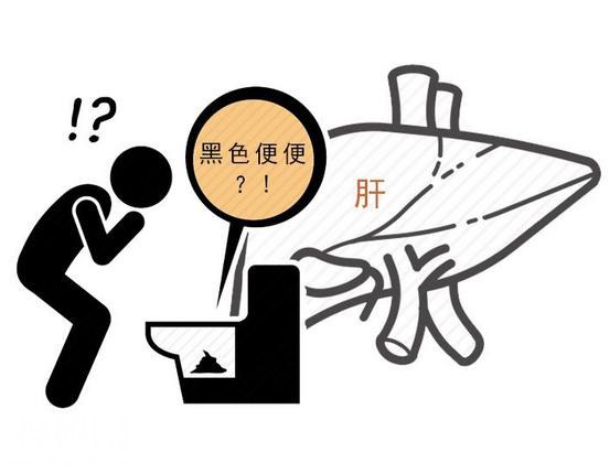 劝告：上厕所时多观察一下，若出现4种现象，或许肝出问题了-3.jpg