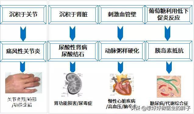 体检发现尿酸高别担心，医生教您如何复查，确实高了应该如何控制-5.jpg