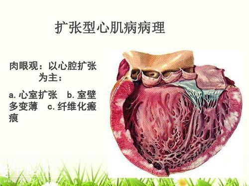 网易裁掉身患绝症员工，到底这种“绝症”有多可怕？医生告诉你-2.jpg