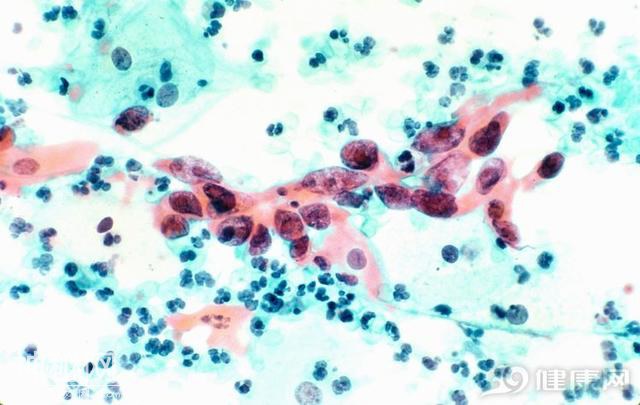 感染病毒有特殊体味？英国：正训练“检测犬”，已能筛查癌症疟疾-5.jpg