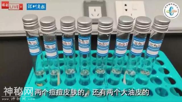 戴口罩还化妆，她的脸烂了！医生做了一个细菌实验，结果惊人！-14.jpg