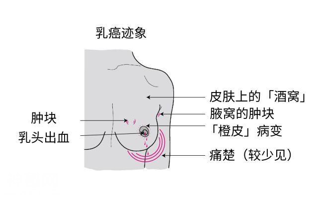 【注意】一年新增近2.8万患者！一地公布最新癌症榜，这种病最高发-9.jpg