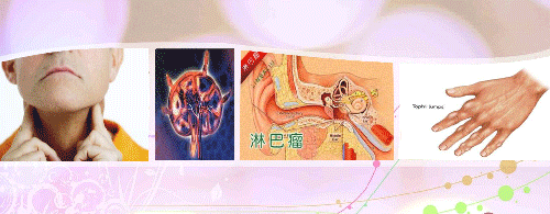 【注意】一年新增近2.8万患者！一地公布最新癌症榜，这种病最高发-15.jpg