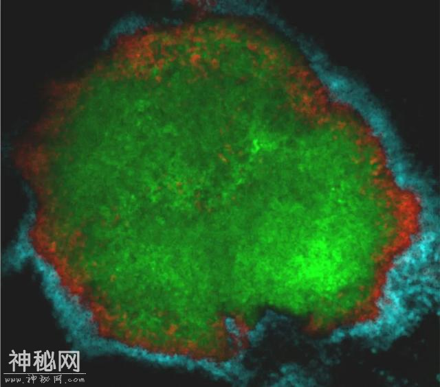 细菌是这样引起蛀牙的！与此同时，科学家发现了清除牙菌斑的关键-5.jpg