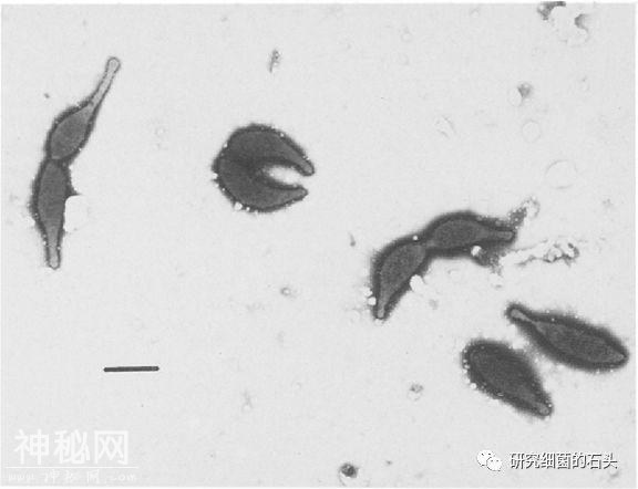 收藏｜56张图片带您认识细菌长啥样？-18.jpg