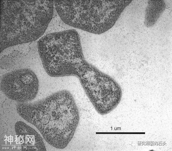 收藏｜56张图片带您认识细菌长啥样？-24.jpg