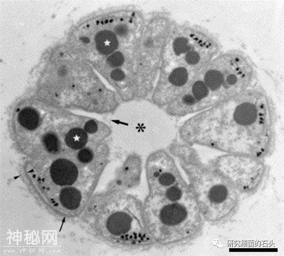 收藏｜56张图片带您认识细菌长啥样？-26.jpg