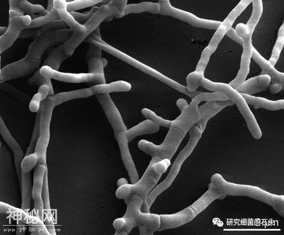 收藏｜56张图片带您认识细菌长啥样？-31.jpg