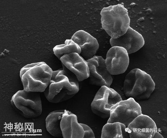 收藏｜56张图片带您认识细菌长啥样？-33.jpg