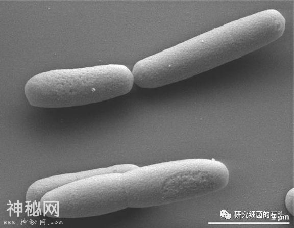 收藏｜56张图片带您认识细菌长啥样？-36.jpg